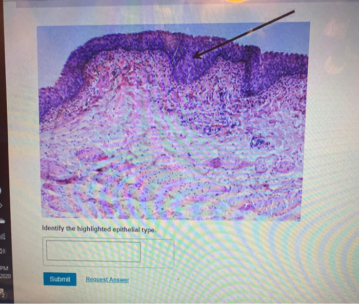 Solved Identify the highlighted epithelial type. PM 2020 | Chegg.com