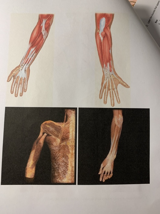 Solved: Muscle Of The Chest, Shoulder, And Upper Limb 1) F ...