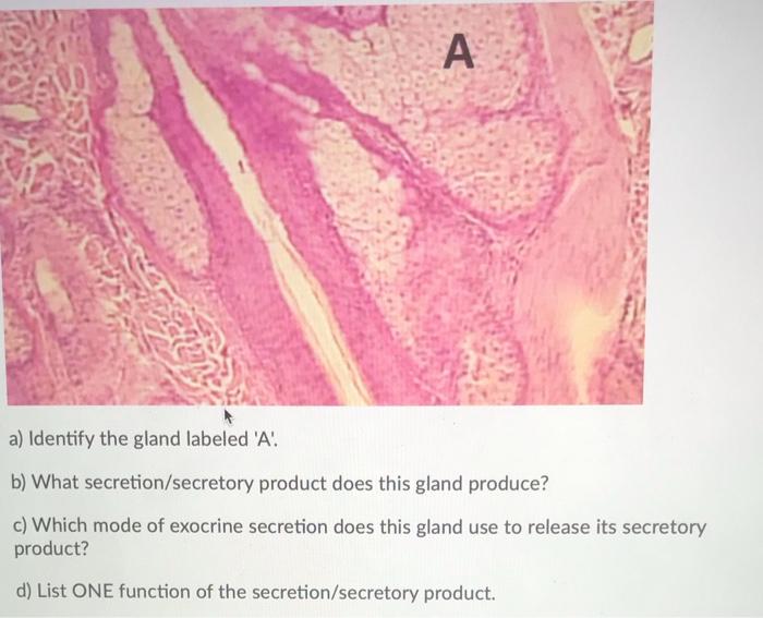 Solved A A Identify The Gland Labeled A B What Chegg Com