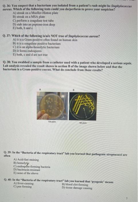 Solved Q. 36: You suspect that a bacterium you isolated from | Chegg.com