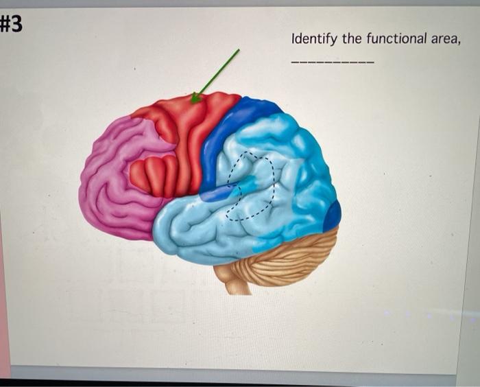 Solved #1 a) Name the elevated ridges b) Name the lobe a b | Chegg.com