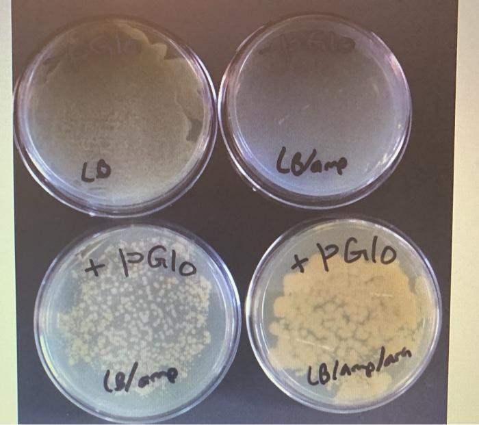 Solved 5. If there is bacterial growth why do the E. coli | Chegg.com