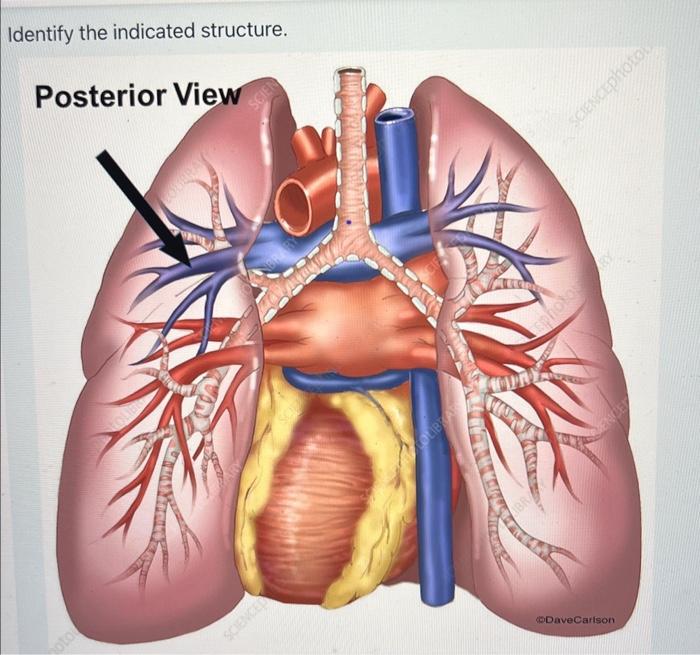 Solved Identify the indicated structure. | Chegg.com