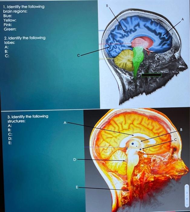 Solved B B 1. Identify The Following Brain Regions: Blue: | Chegg.com