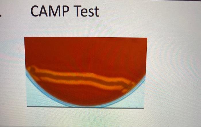 Solved CAMP Test | Chegg.com