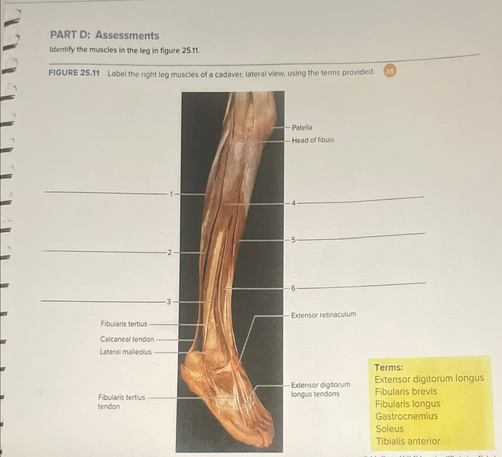 Solved Part D: Assessmentsidentify The Muscles In The Leg In 