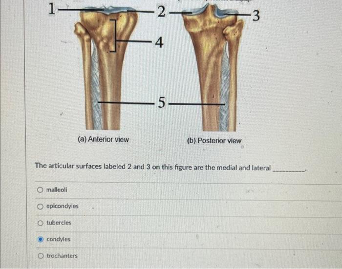 The articular surfaces labeled 2 and 3 on this figure are the medial and lateral
malleoli
epicondyles
tubercles
condyles
troc