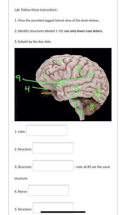 Lateral view of the brain: Anatomy and functions