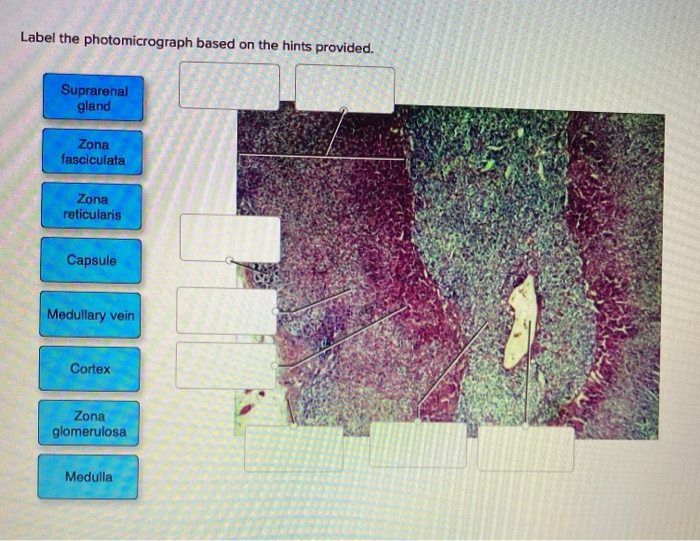 Solved Label The Photomicrograph Based On The Hints | Chegg.com