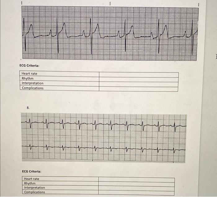 The following rhythm strips are for your practice. | Chegg.com