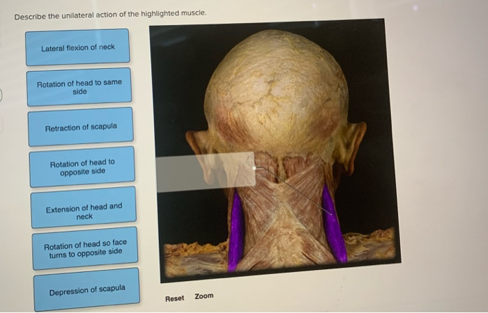 Solved Describe the unilateral action of the highlighted | Chegg.com