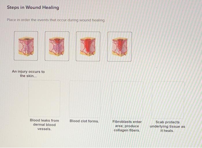 Solved Steps in Wound Healing Place in order the events that