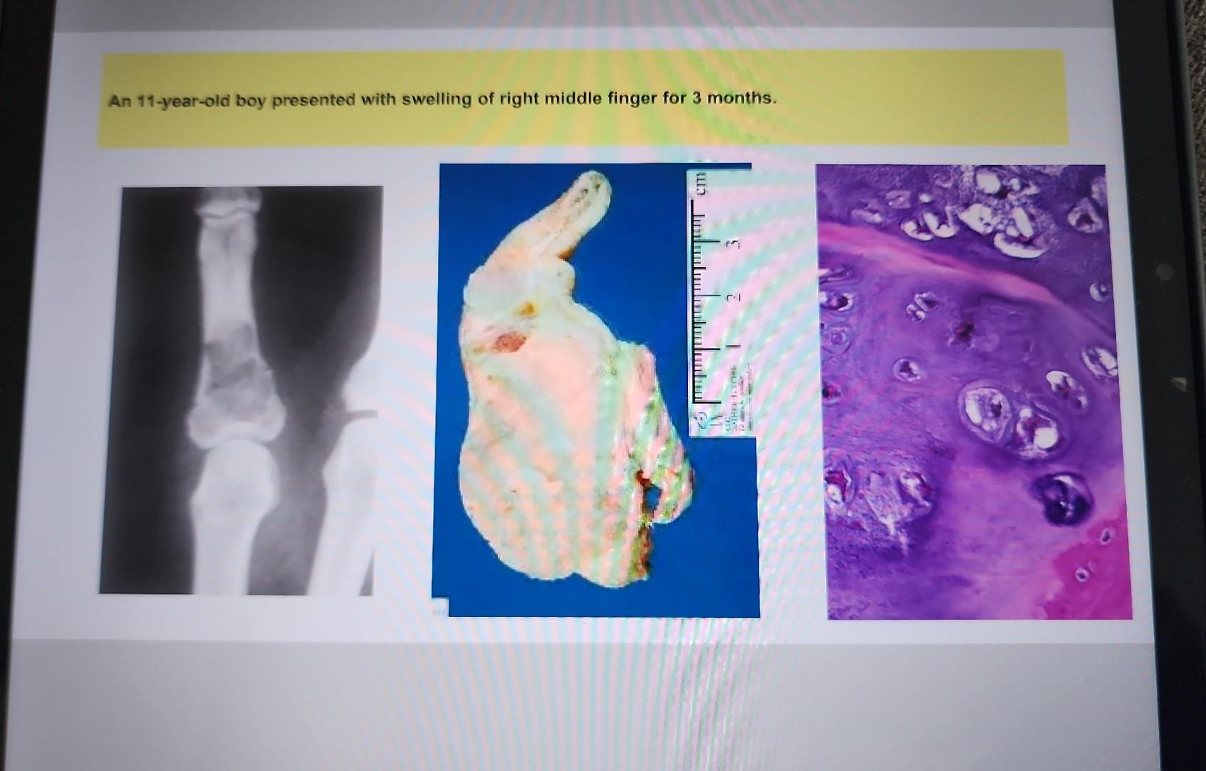 Your Bones Are Fine Understanding Unremarkable In Radiology - jiq2nt6