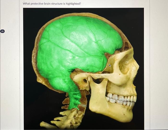 What protective brain structure is highlighted? | Chegg.com