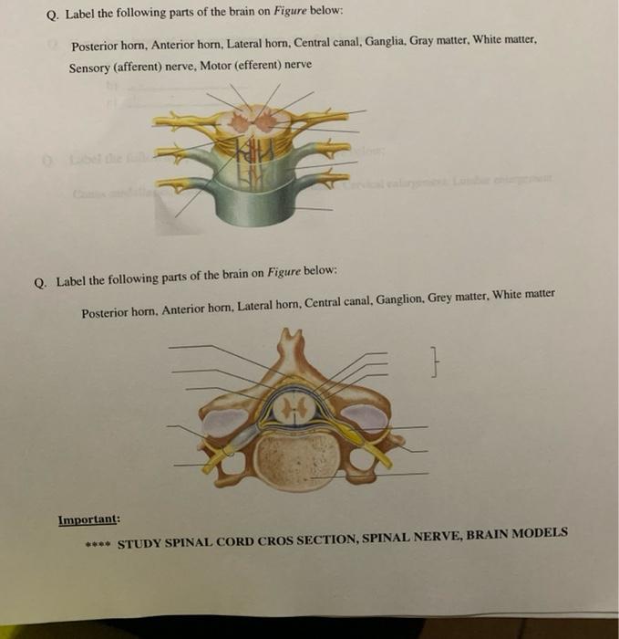 Solved Q. Label the following parts of the brain on Figure