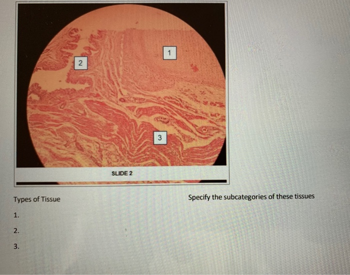 trachea slide labeled