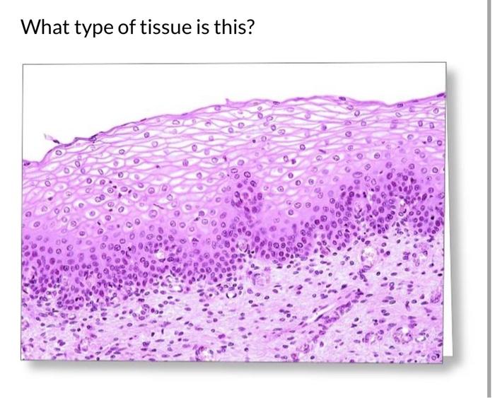 solved-what-type-of-tissue-is-this-chegg