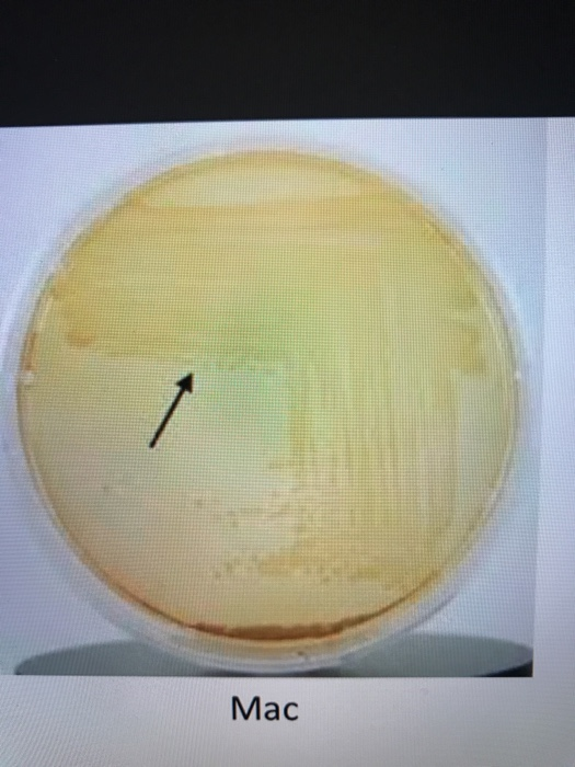 Urease Streaking Solved @ Q Search 23 Mac KIA SIM Urease Gram stain Streak on | Chegg.com