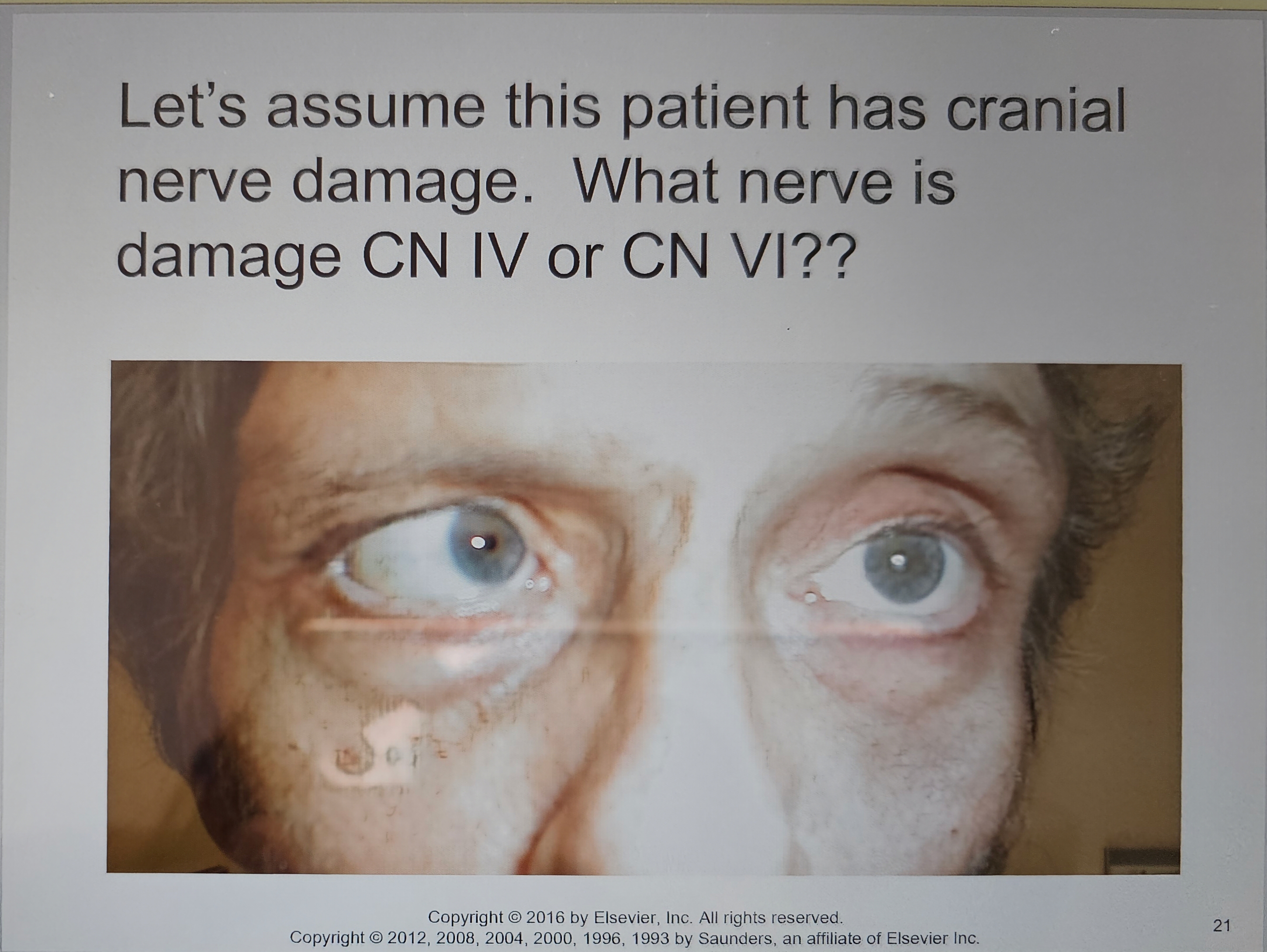 Solved Let's assume this patient has cranialnerve damage. | Chegg.com