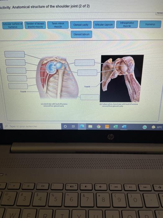 Solved Activity: Anatomical structure of the shoulder joint | Chegg.com