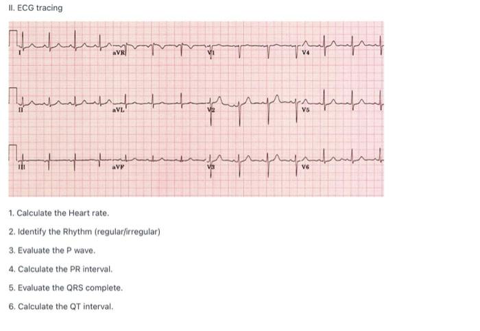 II. ECG tracing للمعلم مملممم للملی مسلم لمعلميا AVL programmet aVP 1 للسليسلم V6 1. Calculate the Heart rate. 2. Identify th