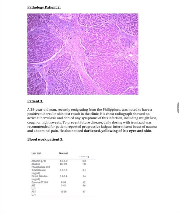 sample case study of liver disease