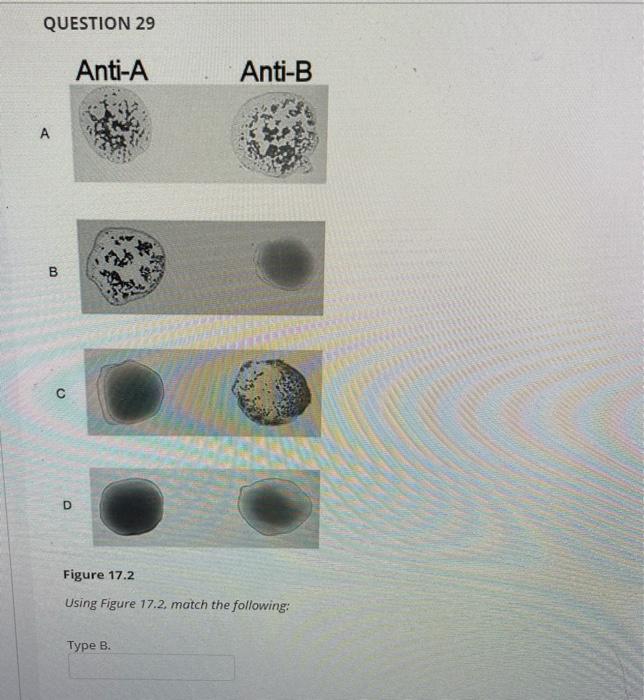 Solved QUESTION 3 Anti-A Anti-B 7. A 0$ B с Figure 17.2 | Chegg.com