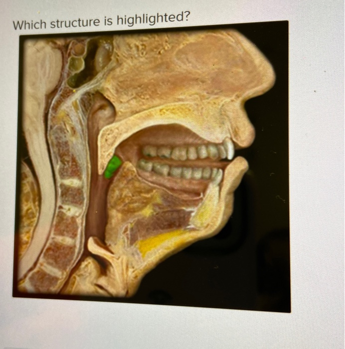 solved-which-structure-is-highlighted-multiple-choice-chegg