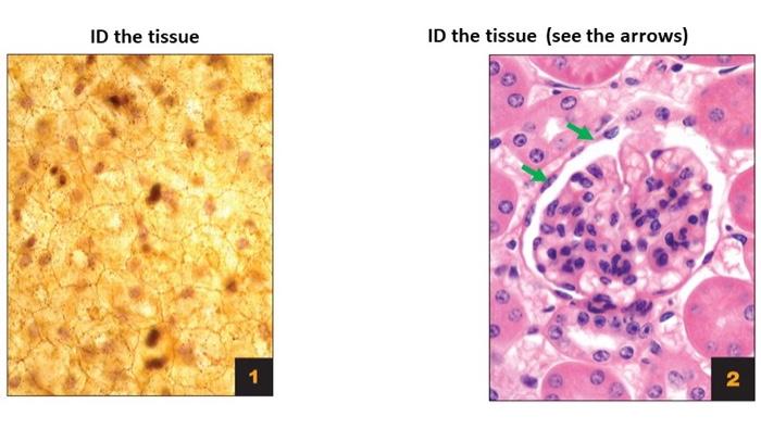 Solved ID the tissue ID the tissue (see the arrows) 1 N | Chegg.com