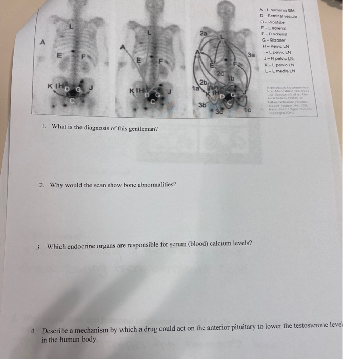 Solved Case 2 A 67-year-old retired male went to his doctor, | Chegg.com