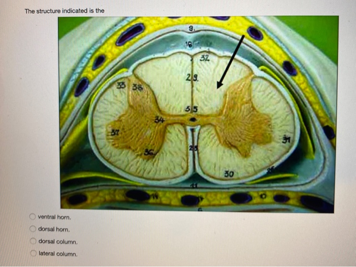 Solved The structure indicated is the ventral horn. dorsal
