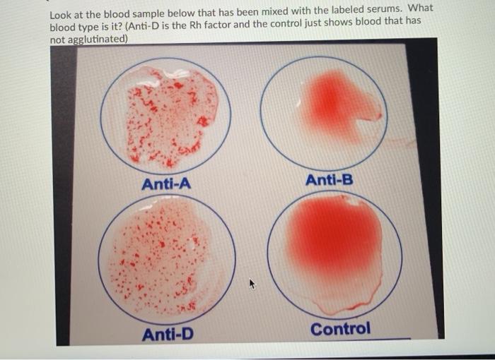 Solved Look at the blood sample below that has been mixed | Chegg.com