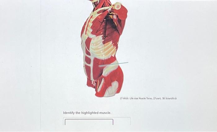 Solved Identify The Highlighted Muscle. LT-VA16: Life-size | Chegg.com