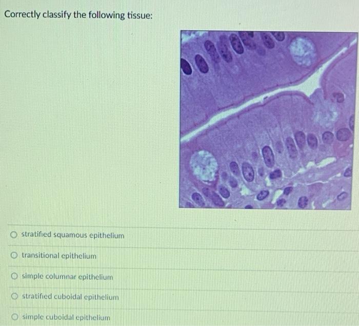 Solved Correctly Classify The Following Tissue: Stratified 