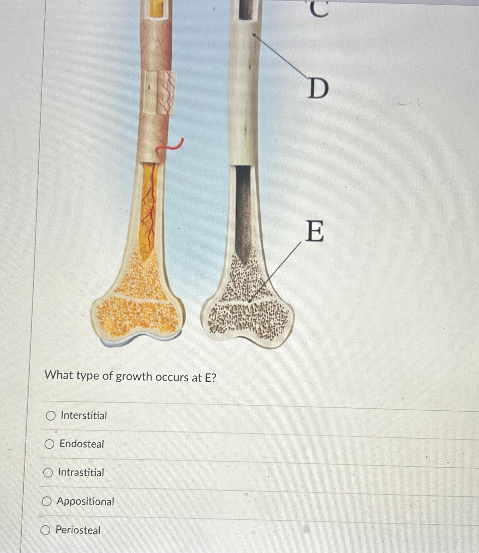 Solved What type of growth occurs at