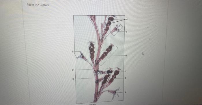 Solved Fill in the Blanks Label the Obello sp. colony. | Chegg.com
