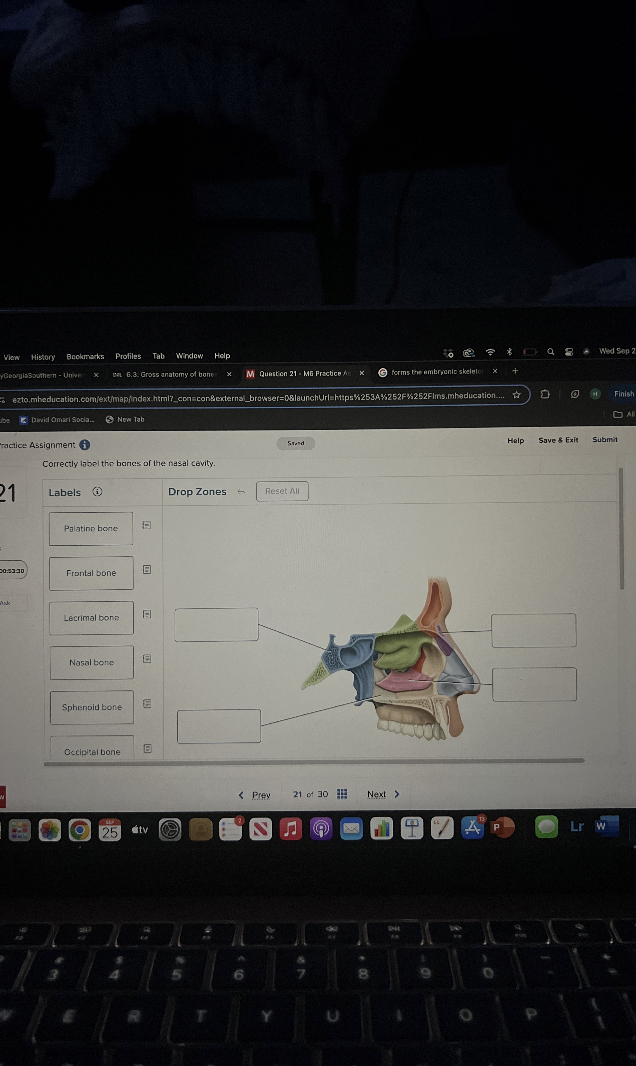 Solved Correctly label the bones of the nasal cavity.Frontal