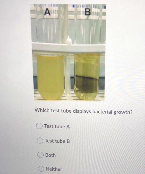 Solved А B Which test tube displays bacterial growth? Test