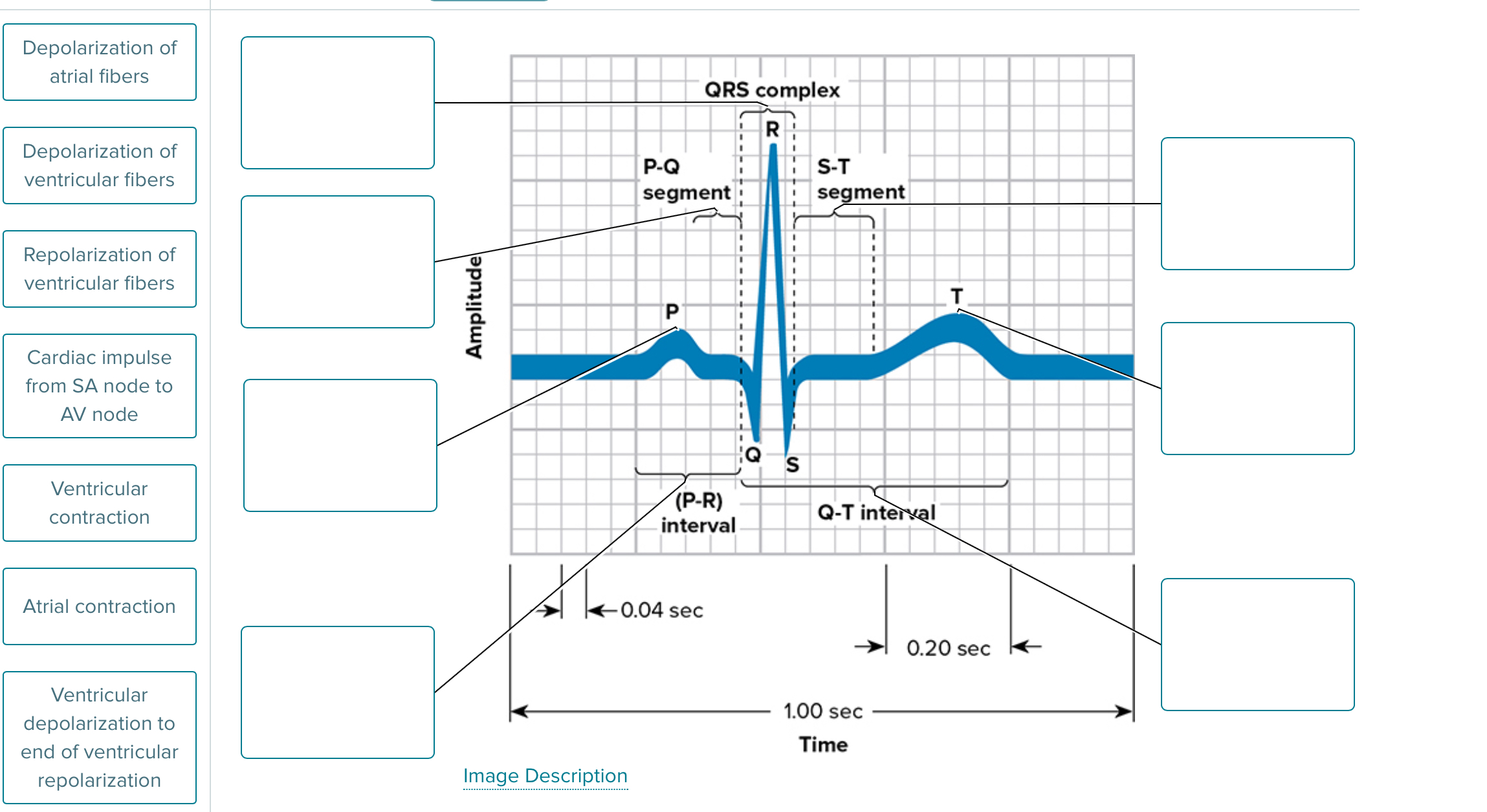 Solved Interpet the compinets of a normal ECG pattern with a | Chegg.com