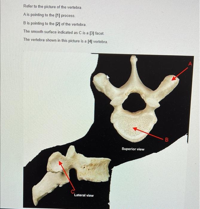 Solved Refer to the picture of the vertebra. A is pointing | Chegg.com