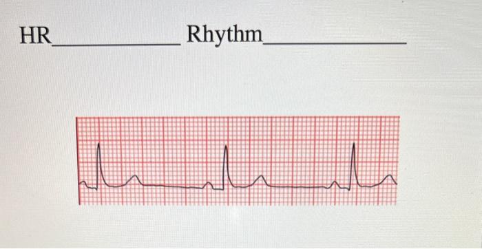 Solved HR RhythmHR Rhythm | Chegg.com