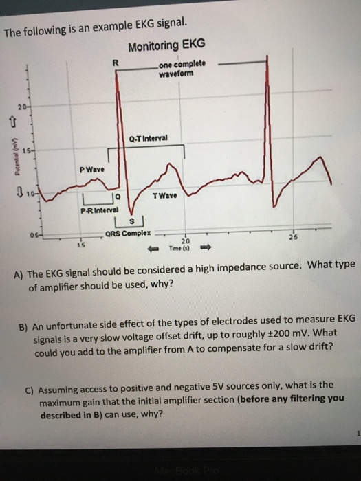 The following is an example EKG signal. Monitoring | Chegg.com