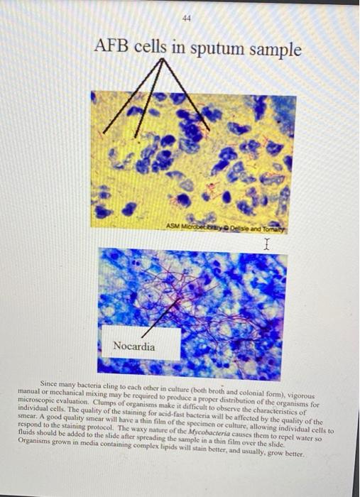 Solved Week 4 Lab Activity 1: Acid Fast Staining the second | Chegg.com