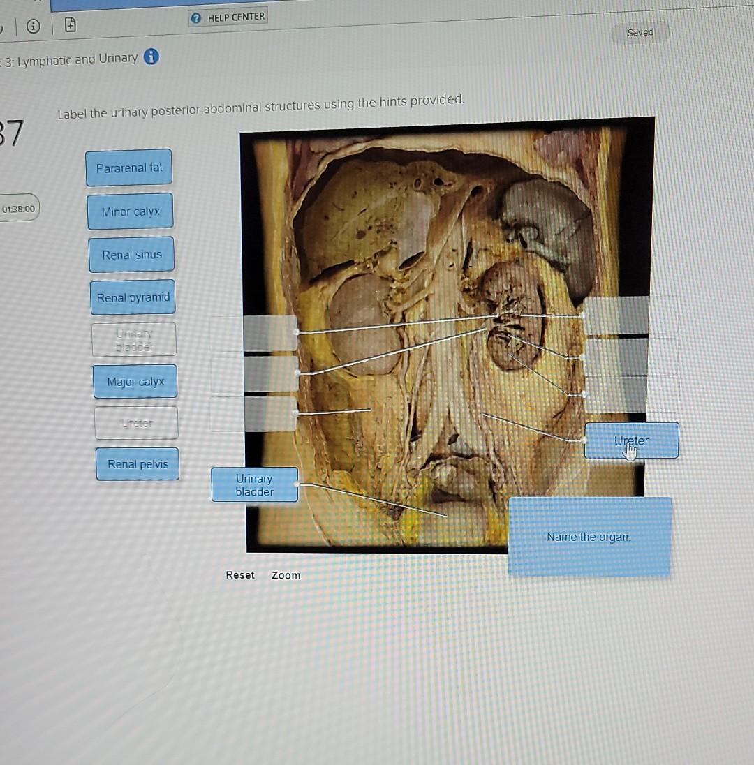 Solved HELP CENTER Saved 3: Lymphatic and Urinary Label the | Chegg.com