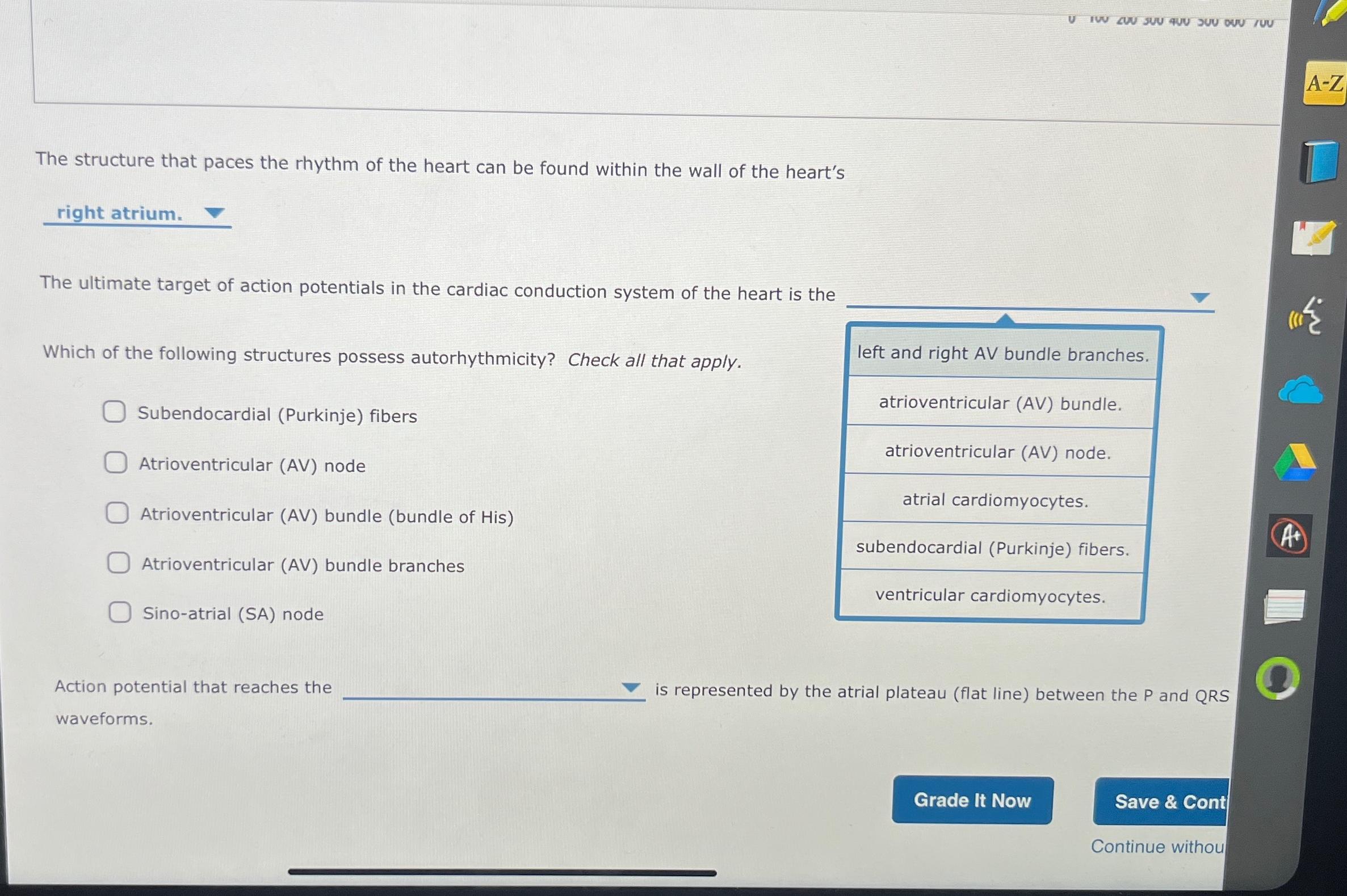 Solved The structure that paces the rhythm of the heart can | Chegg.com