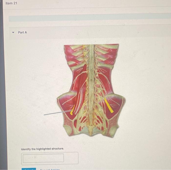 Solved Identify the highlighted structure. | Chegg.com