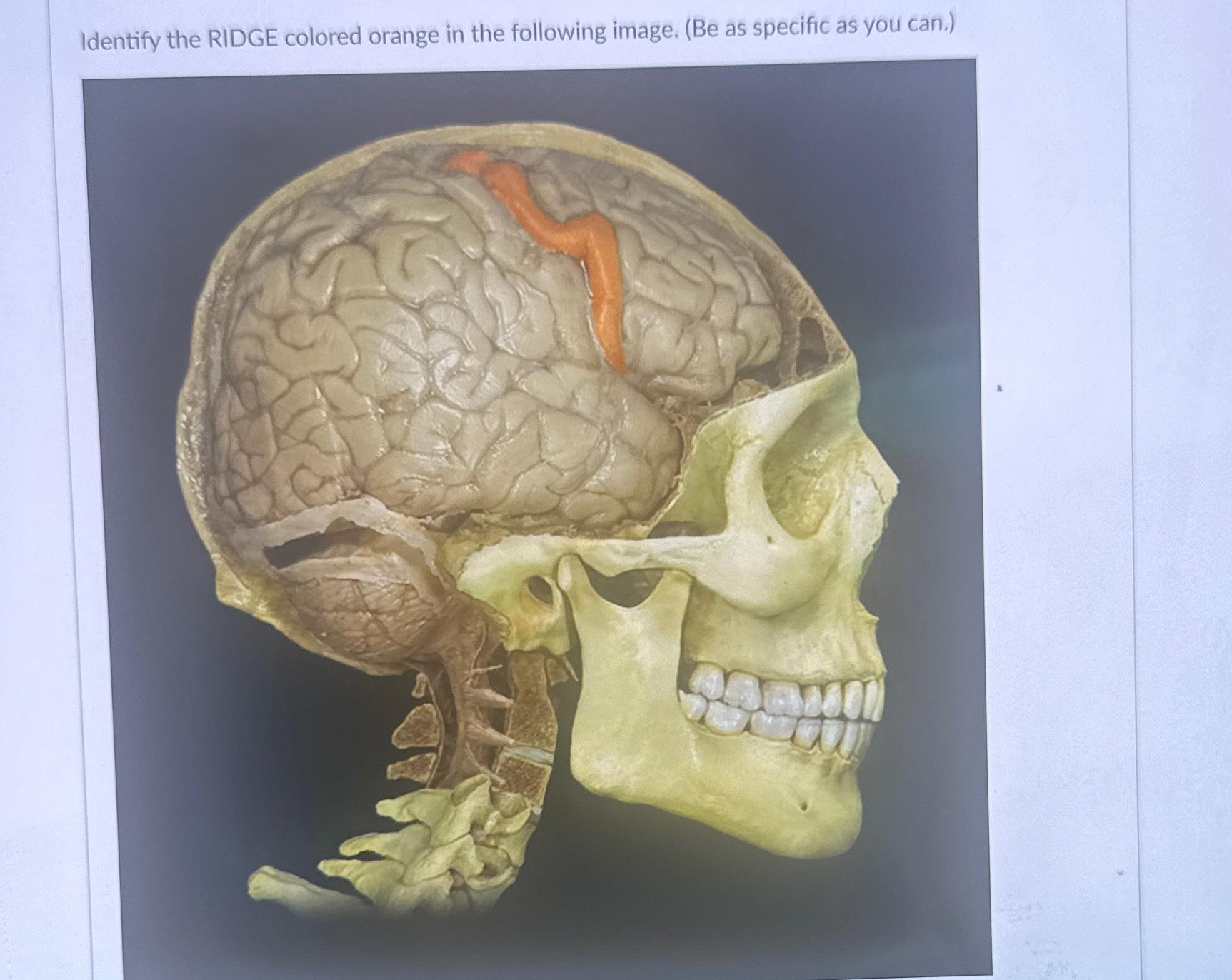 Solved Identify the RIDGE colored orange in the following | Chegg.com
