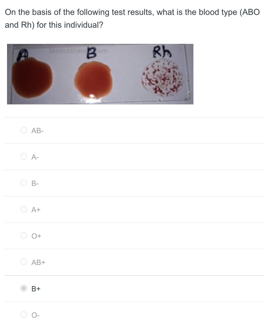 Solved On the basis of the following test results, what is | Chegg.com