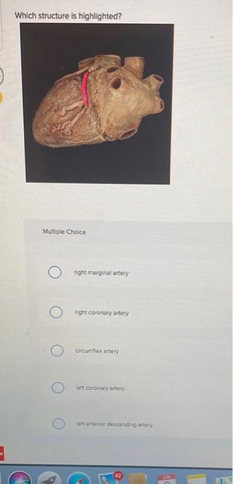 Which structure is highlighted?
Multiple Choice
right marginal artery
right coronary artery
circumflex artery
eft coronary ar