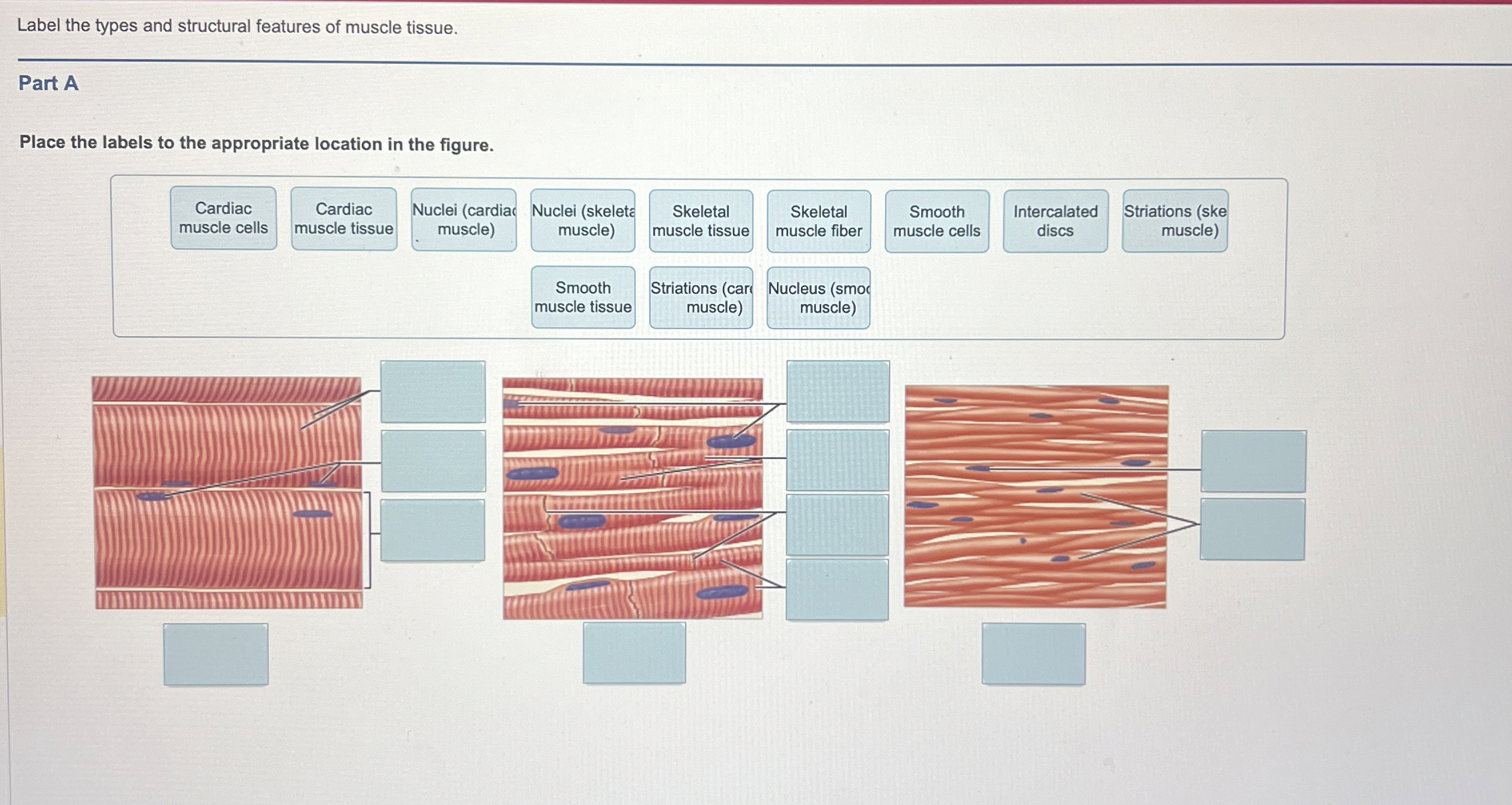 Solved Label the types and structural features of muscle | Chegg.com